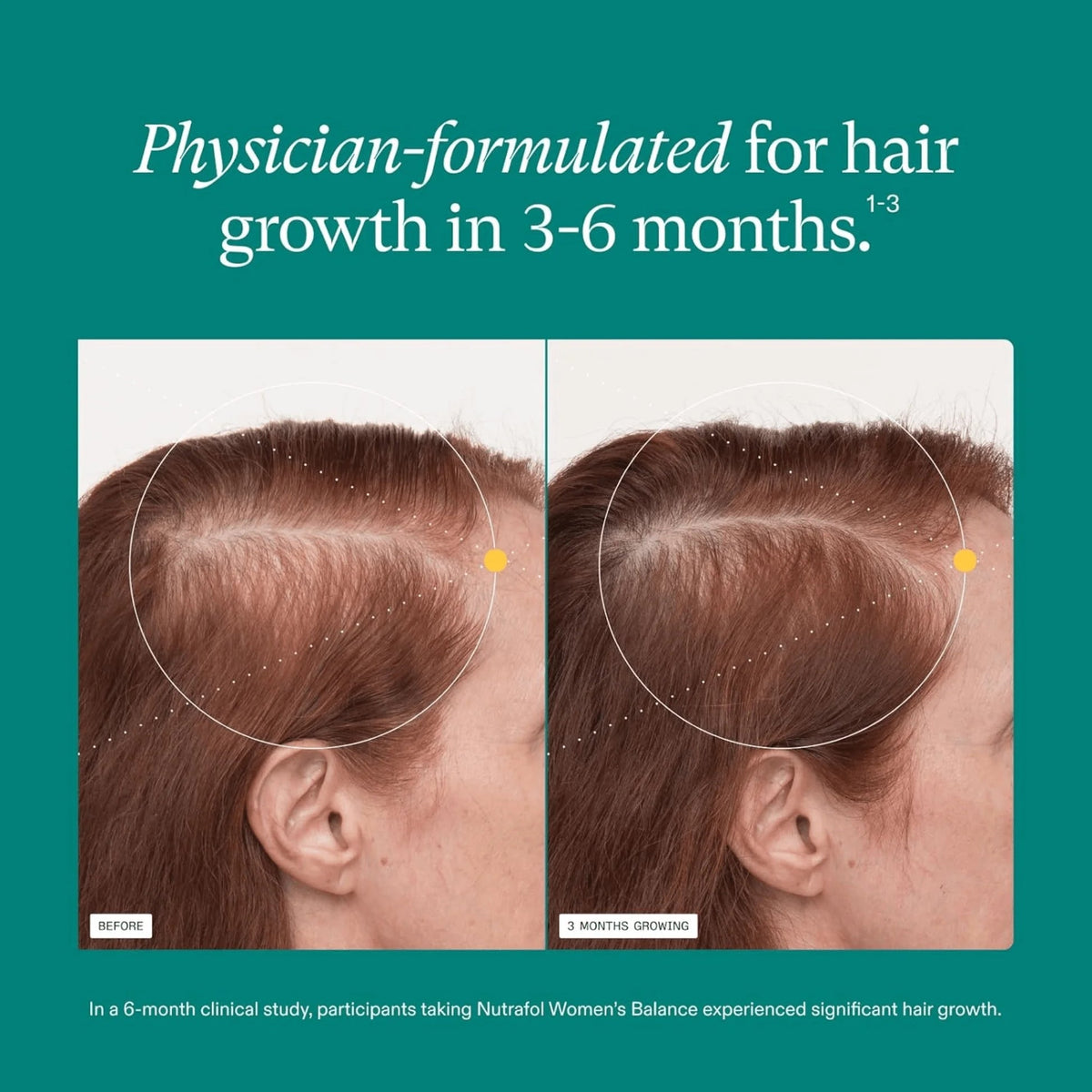 Nutrafol Women Hair Growth Supplements Ages 18-44 – Vegan 1-Month Bottle for Thicker, Healthier-Looking Hair