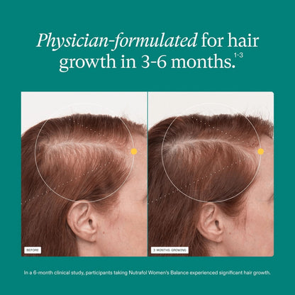 Nutrafol Women Hair Growth Supplements Ages 18-44 – Vegan 1-Month Bottle for Thicker, Healthier-Looking Hair