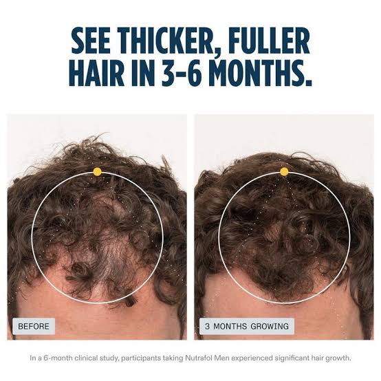 Nutrafol Men Hair Growth Supplements Ages 18–49 – 1-Month Bottle for Stronger, Thicker-Looking Hair